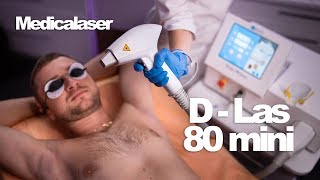 Диодный лазер с антифризом! Обзор модели D-las 80 mini!