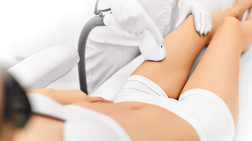 технологія епіляції ipl