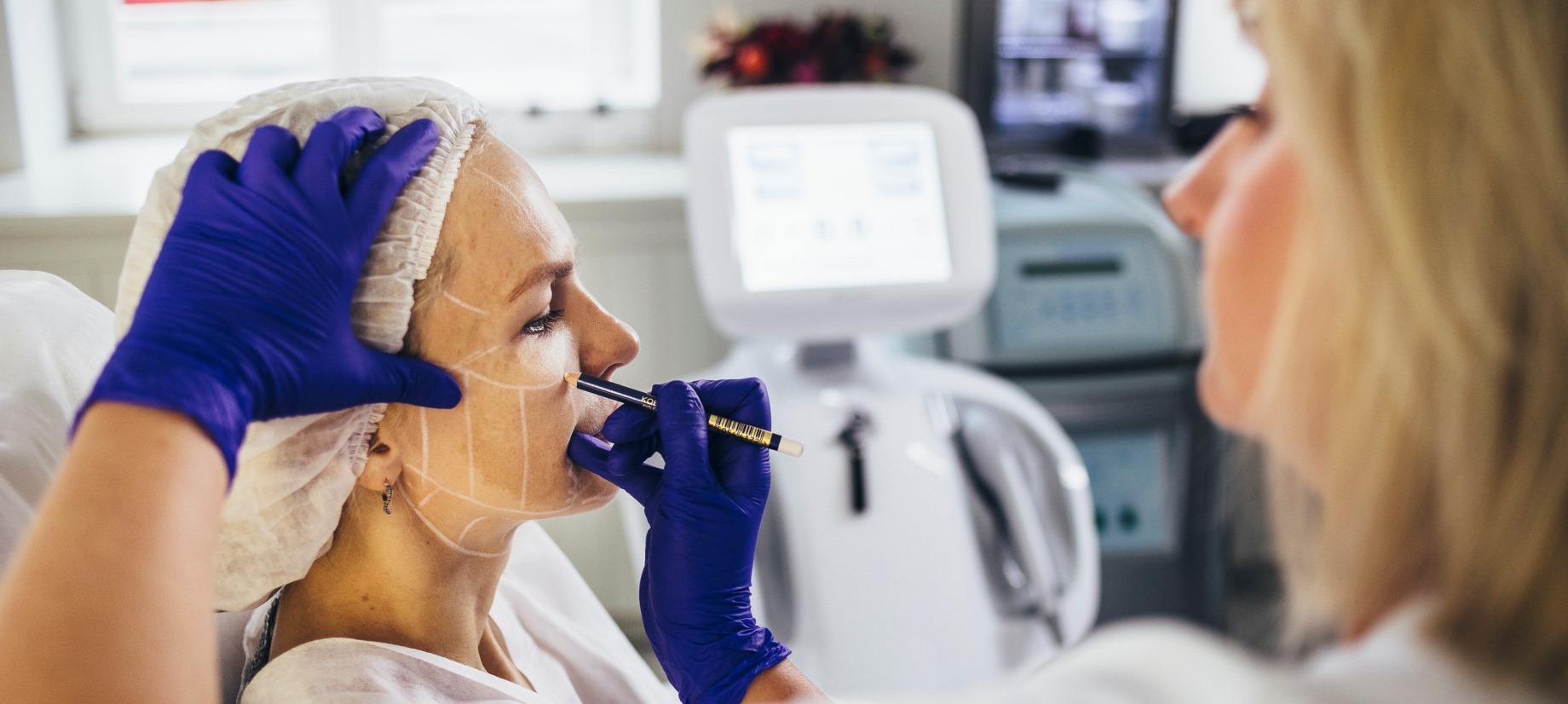 SMAS лифтинг противопоказания