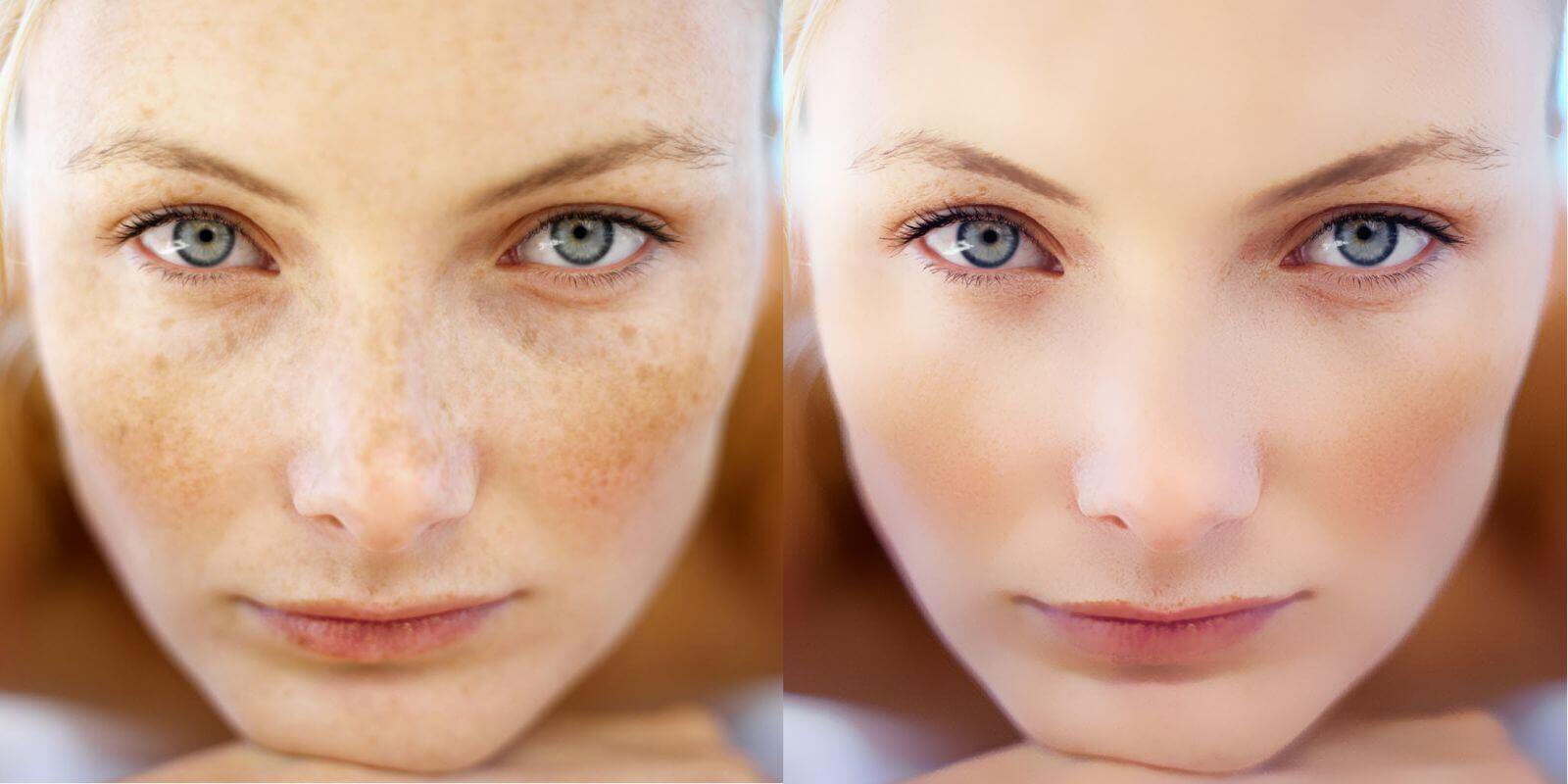 лазерная шлифовка эффект