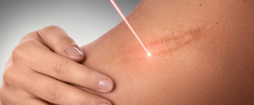 позбутися шраму на обличчі