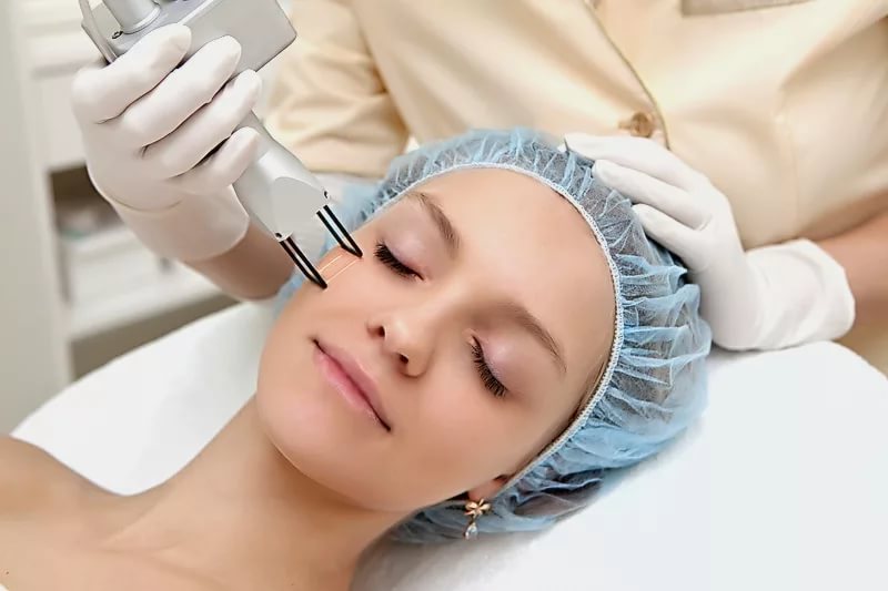 Лазерні методи омолодження