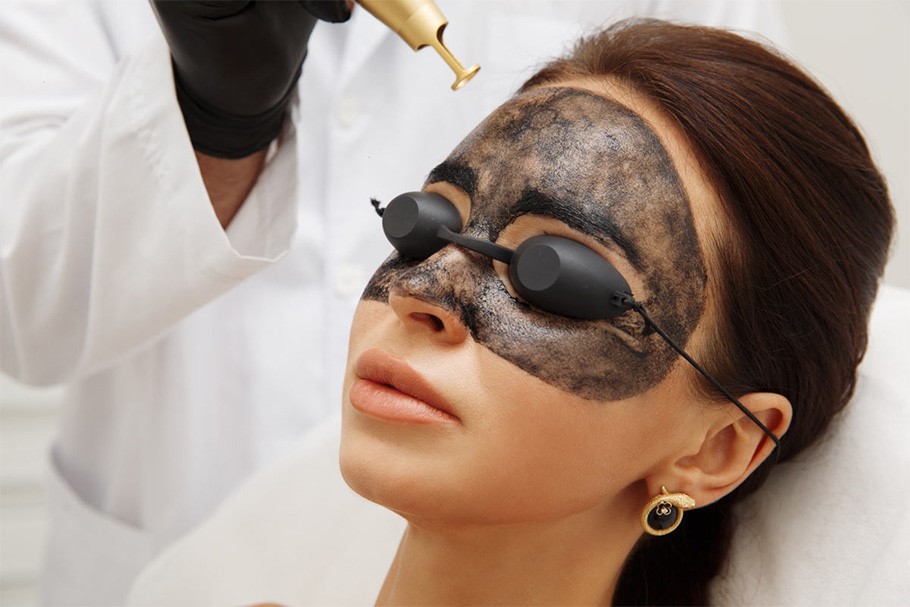 карбоновий пілінг як часто робити