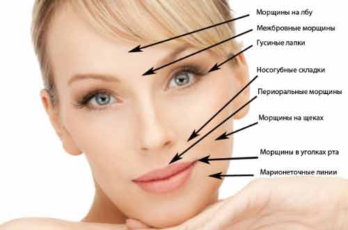 як прибрати зморшки маріонетки