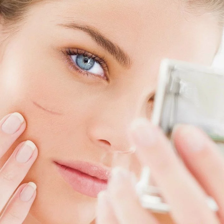 як прибрати шрам на обличчі